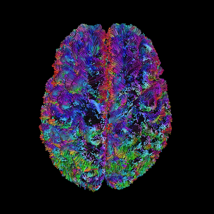 MRI Brain image 3