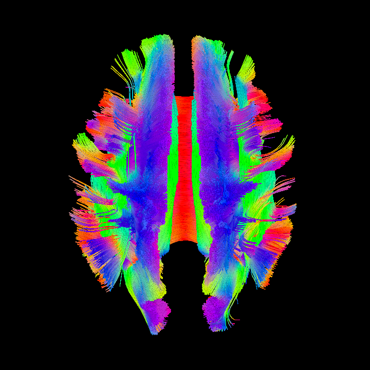 MRI Brain image 4